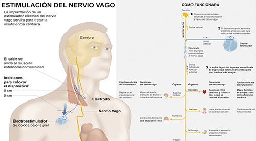 quÉ Es El Nervio Vago Función Estimulación Y Todo Lo Que Debes Saber