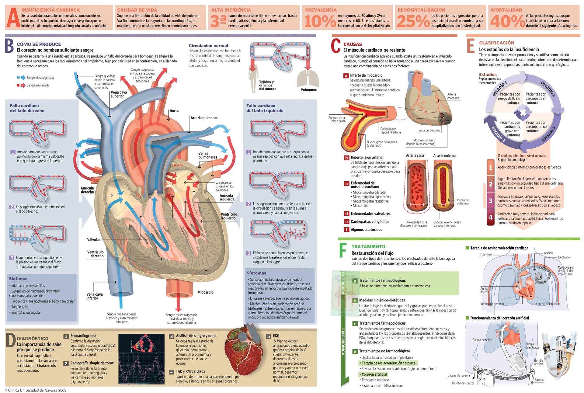 Insuficiencia Cardiaca Causas Síntomas Y Pronóstico Clínica