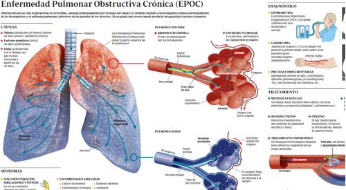 Saber Mas Sobre La Enfermedad Pulmonar Obstructiva Cronica (EPOC)